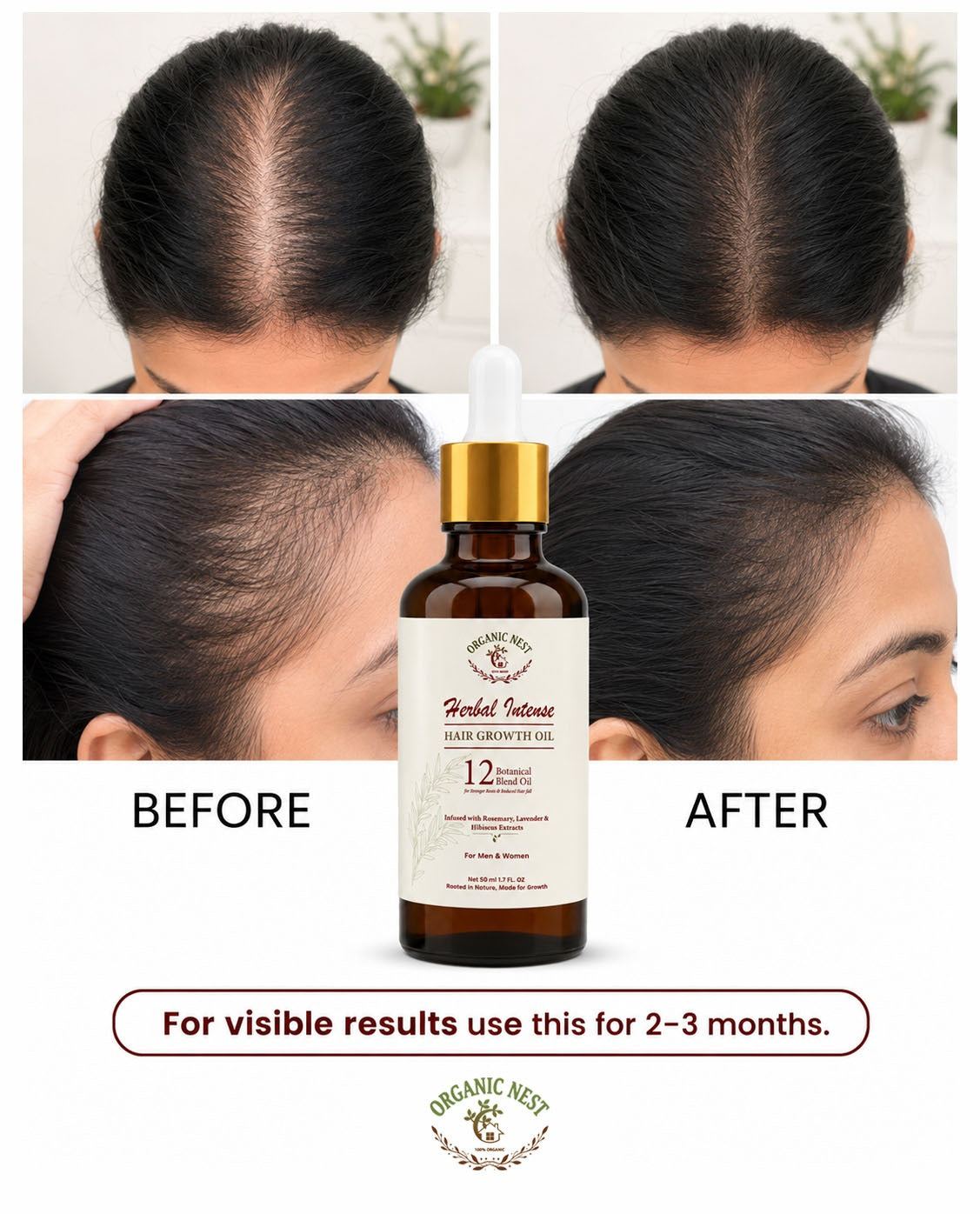 Organic Nest Herbal Intense Hair Growth Oil with 12 botanical blend, featuring natural ingredients in a clear bottle.