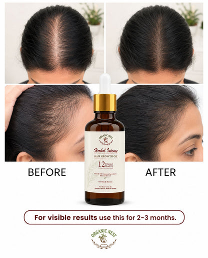 Organic Nest Herbal Intense Hair Growth Oil with 12 botanical blend, featuring natural ingredients in a clear bottle.